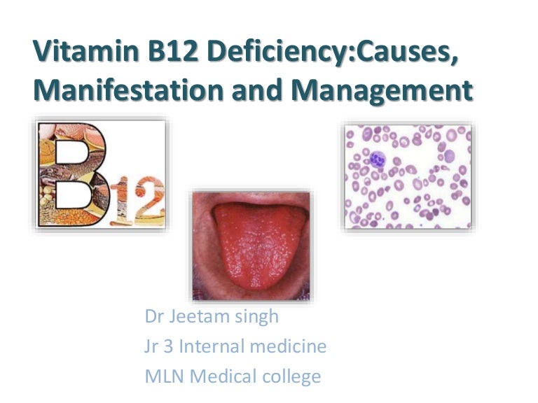 Vit b12 deficiency causes and management