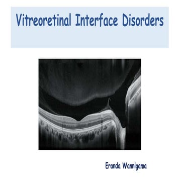 Vitreoretinal interface disorders