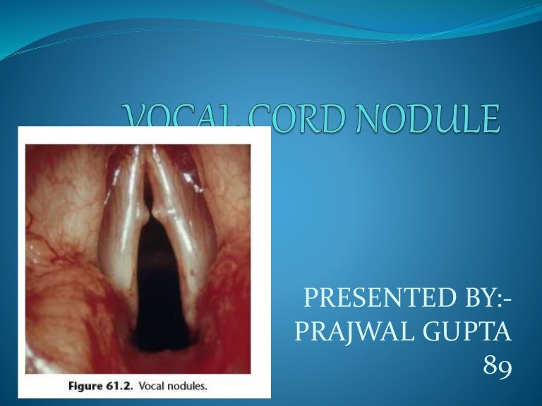 Vocal Nodules