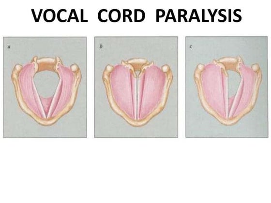 Stroboscopy | PPT