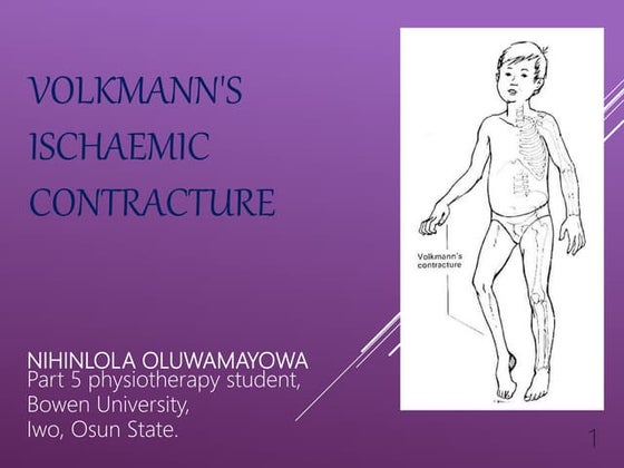 Volkmann’S Contracture Diagnosis – OHYDHC