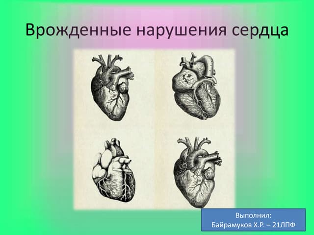 Пролапс трехстворчатого клапана