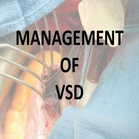 VENTRICULAR SEPTAL DEFECT | PPT