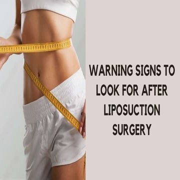 Liposuction-Overview.pptx