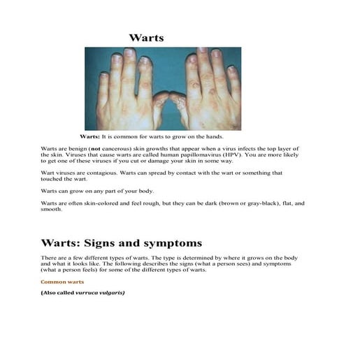 Warts
