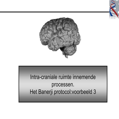 Banerji Protocols - Hersentumor 3