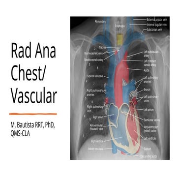 Comprehensive Radiographic Anatomy of the Chest and Heart Structures | PPSX