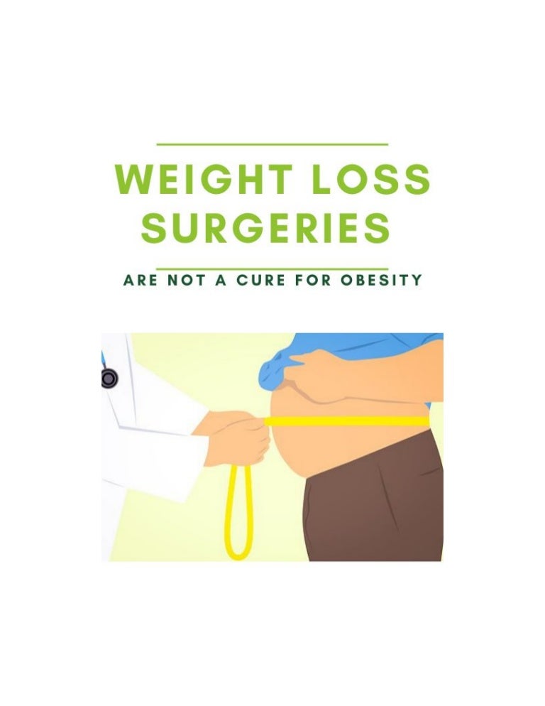 Weight loss surgeries