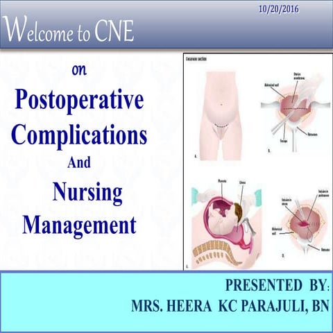 Postoperative complication and nursing management | PPSX