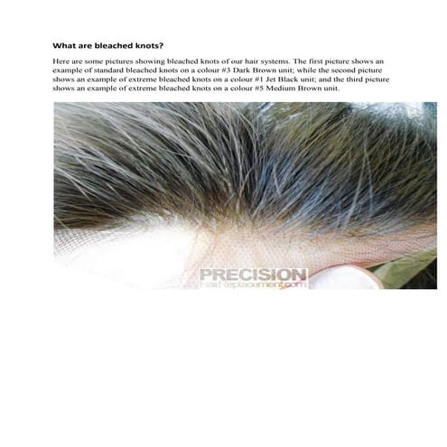 What are bleached knots