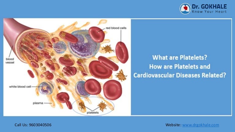 Disease Lack Of Platelets , Thrombocytopenia: Symptoms, Stages ...