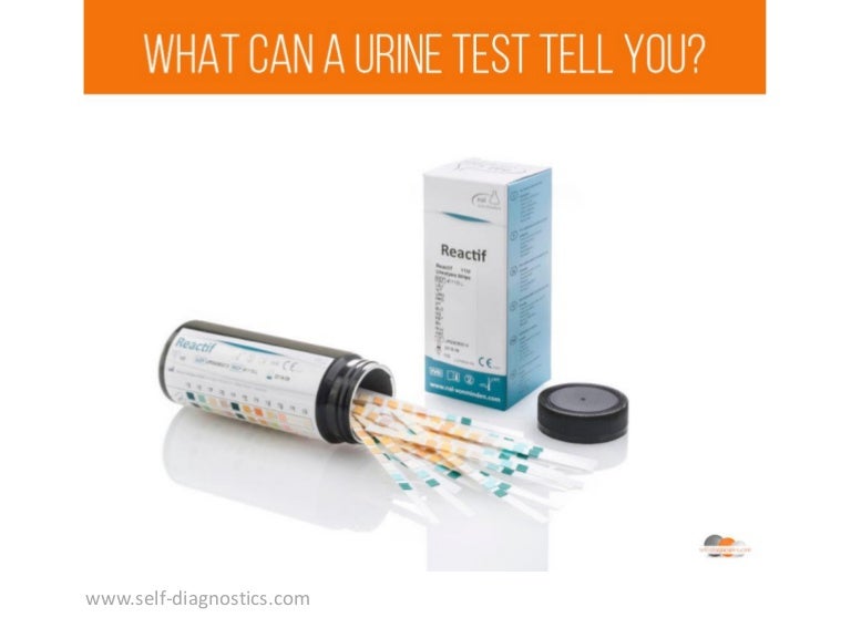 What can a urine test tell you?