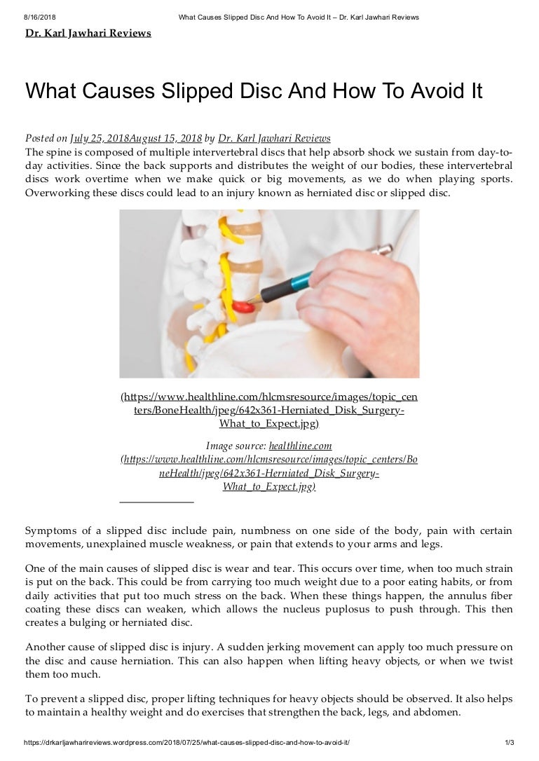 What causes slipped disc and how to avoid it