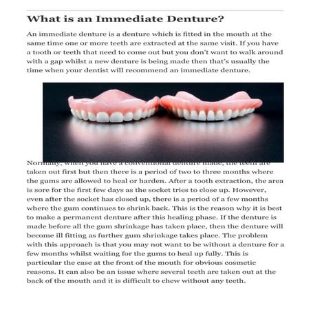 What is an Immediate Denture - Dr Muzzafar Zaman