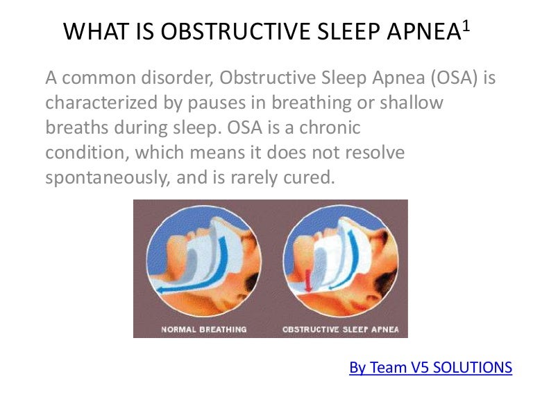 What is obstructive sleep apnea1