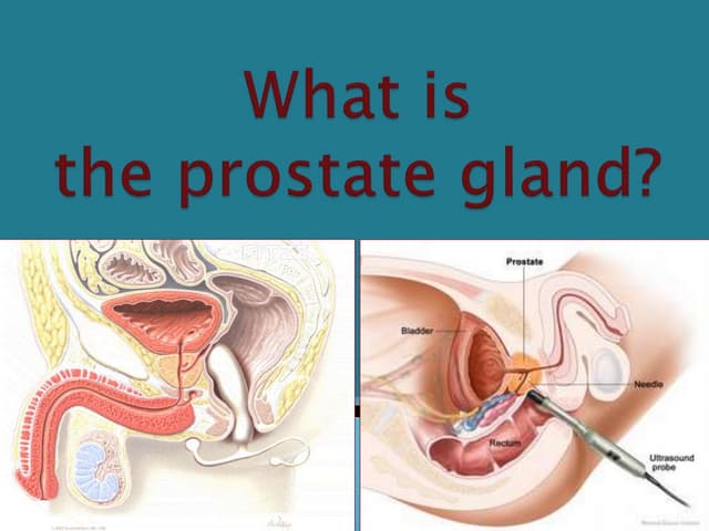 What is the prostate gland?