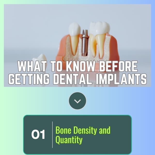 What to Know Before Getting Dental Implants.pdf