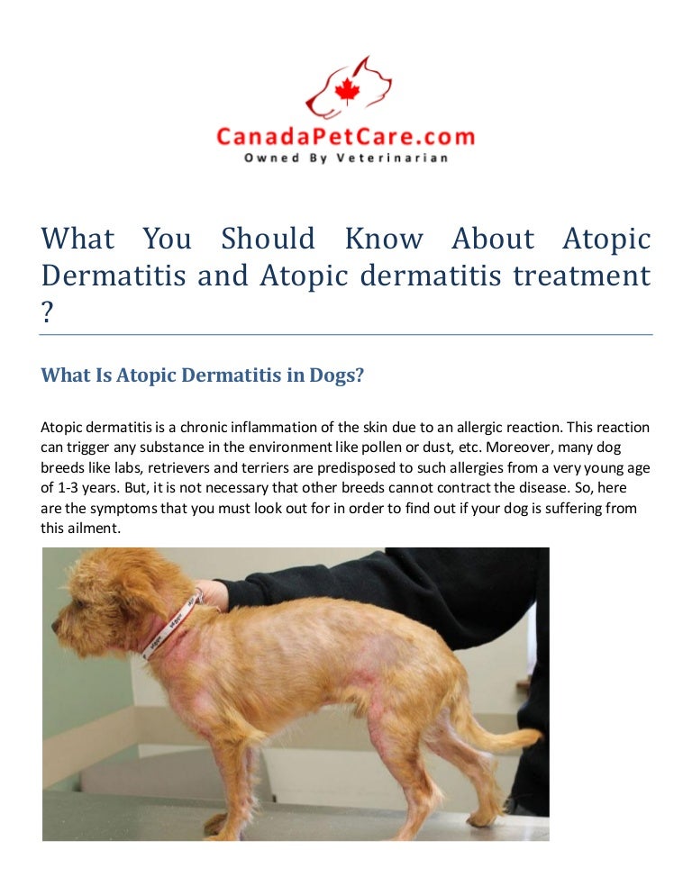 atopic dermatitis care