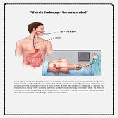 When is Endoscopy Recommended? | PDF