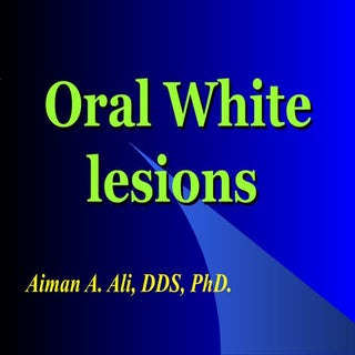 Oral White lesions