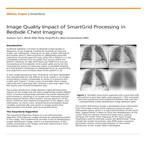 Whitepaper: Image Quality Impact of SmartGrid Processing in Bedside Chest Ima...