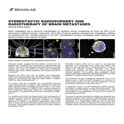 Stereotactic Radiosurgery and Radiotherapy of Brain Metastases Clinical White...