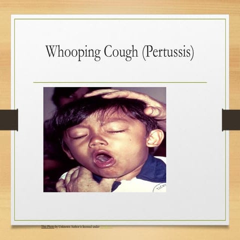Whooping_Cough community nursing_Presentation didi.pptx