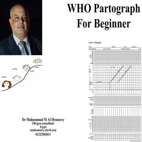 Who partograph