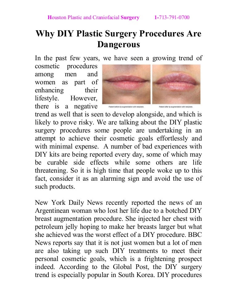 Why DIY Plastic Surgery Procedures Are Dangerous