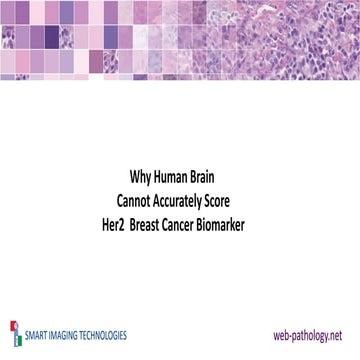 Why Human Brain Cannot Score Her2 Cancer Biomarker
