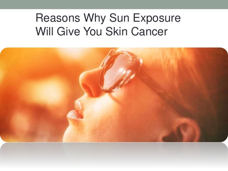 Why sun exposure will give you skin cancer