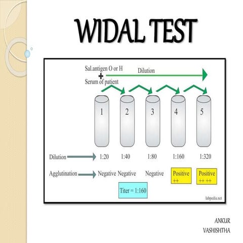 Widal Test 