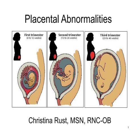 Wiki.placental abnormalities1