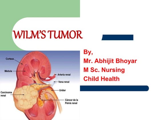 Wilms tumor | PPTX