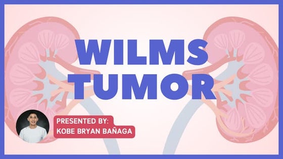 Wilms tumor | PPTX