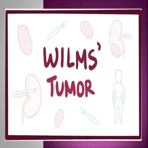 wilms tumor ppt.pptx ppt tumor wilms tumor