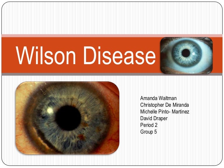 Wilson disease