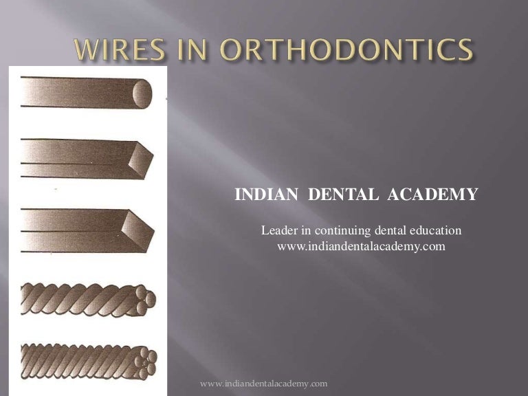 Wires in orthodontics