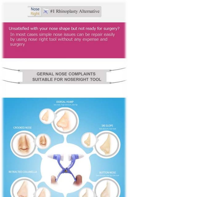 without surgery reshape your nose