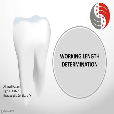 Working length determination apex and the methods | PPTX