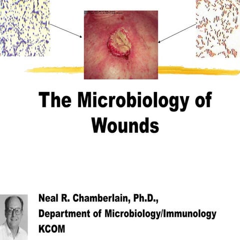 wound the microbiology of wounds -in detail