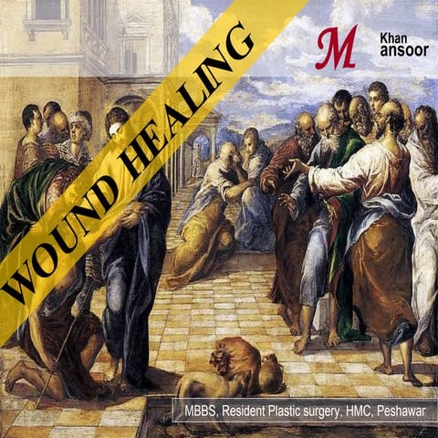 Wound healing