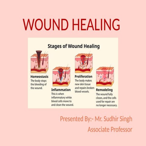 wound healing and it's phases with details | PPTX