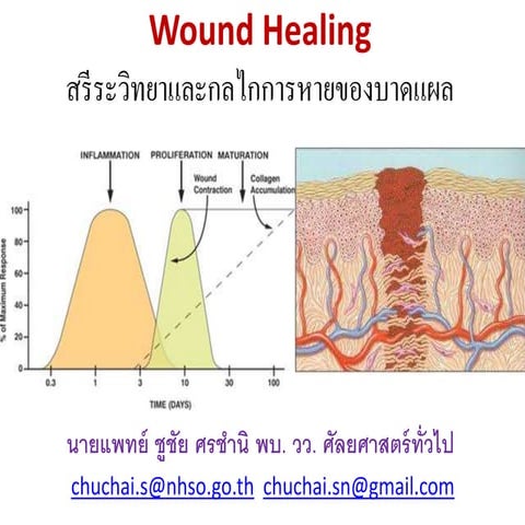 Wound healing 2014