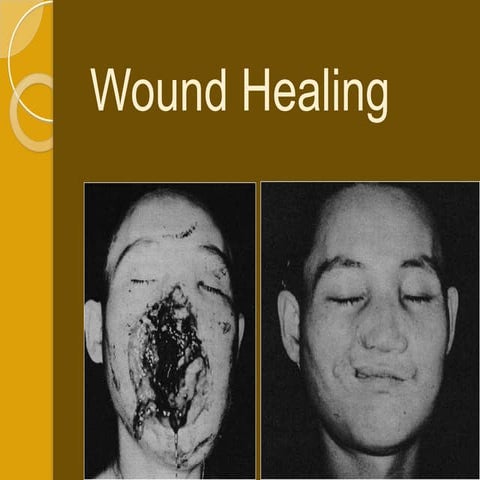 Wound healings