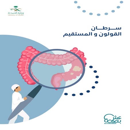 سرطان القولون