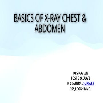 X-Ray BASICS ABDOMEN & CHEST OVERALL BASICS.pptx