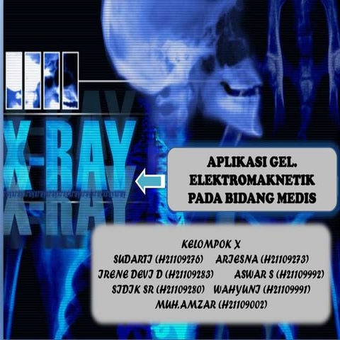X ray (kel x)