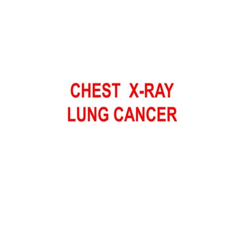 CHEST X-RAYS OF  LUNGCANCER.........pptx