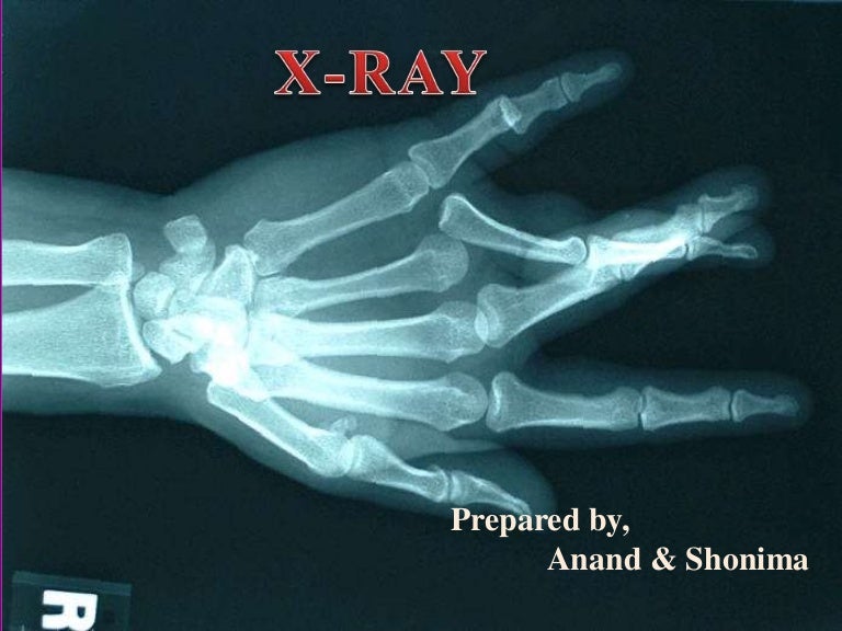 powerpoint presentation on x ray